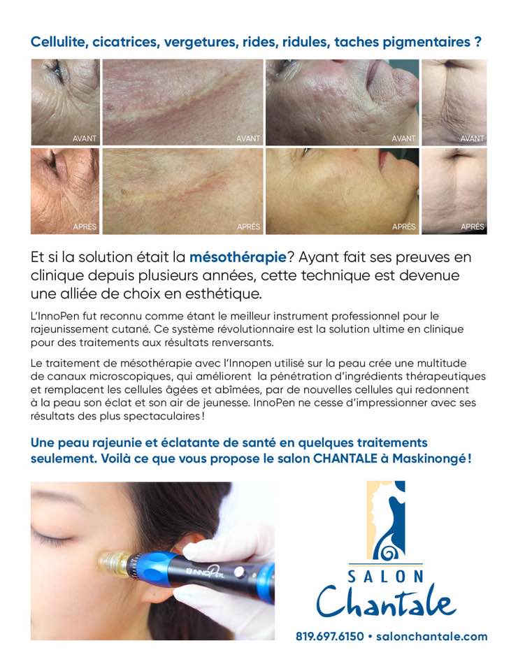 traitement au micro-aiguille, traitement innopen, micro-needling, 